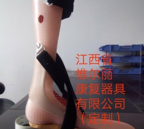 撫州下肢矯形器定制