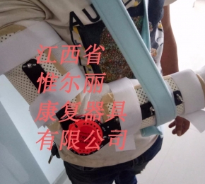 江西景德鎮(zhèn)上肢矯形器