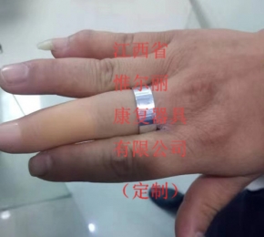 江西江西假肢定制