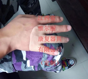 江西江西假肢定做
