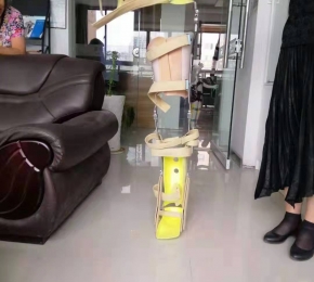 九江下肢矯形器