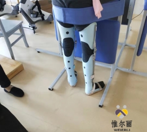 九江下肢矯形器