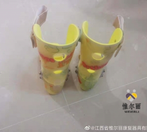 九江下肢矯形器
