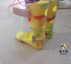 九江下肢矯形器
