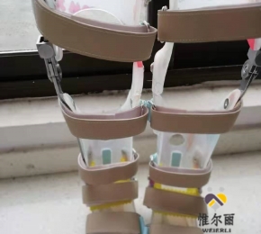 江西下肢矯形器