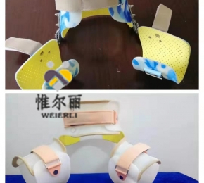 九江下肢矯形器